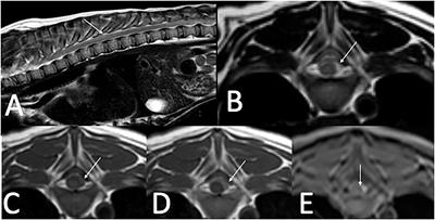 Clinical, Diagnostic, and Imaging Findings in Three Juvenile Dogs With Paraspinal Hyperesthesia or Myelopathy as a Consequence of Hemophilia A: A Case Report